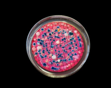 Sanepid zamknął kąpielisko na Malince w Zgierzu Bakteria escherichia coli w wodzie. Kąpielisko na malince w zgierzu zamknięte