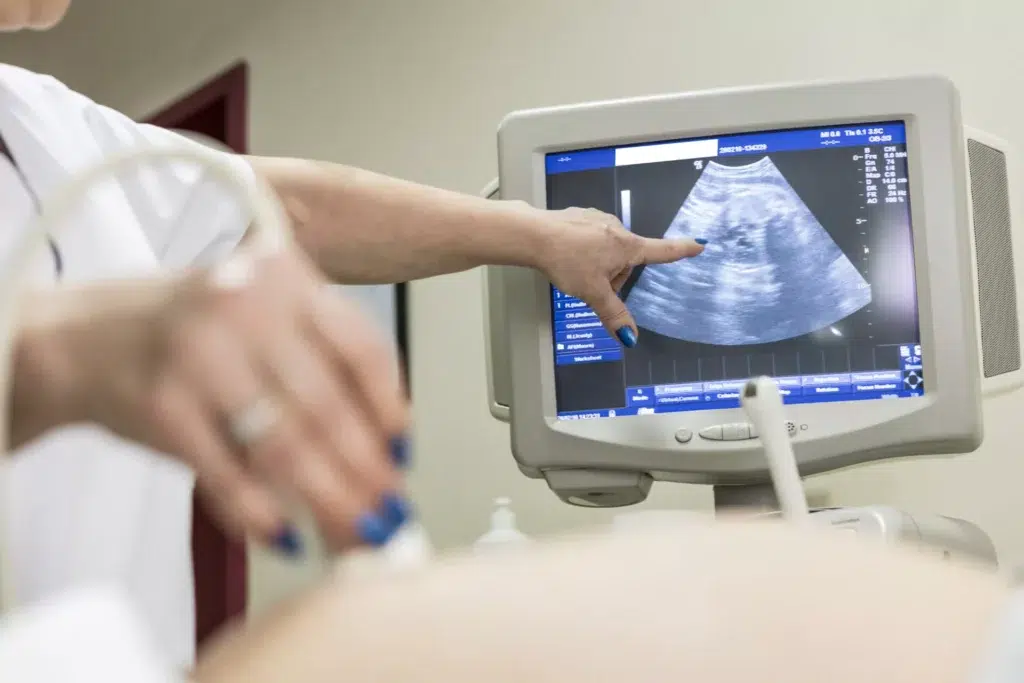 NFZ uznał, że to miała być legalna aborcja. Łódzki szpital zapłaci 200 tysięcy za odmowę 1 Kontrola w szpitalu ckd